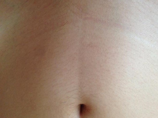 怀孕没黑线的基本是女宝宝了