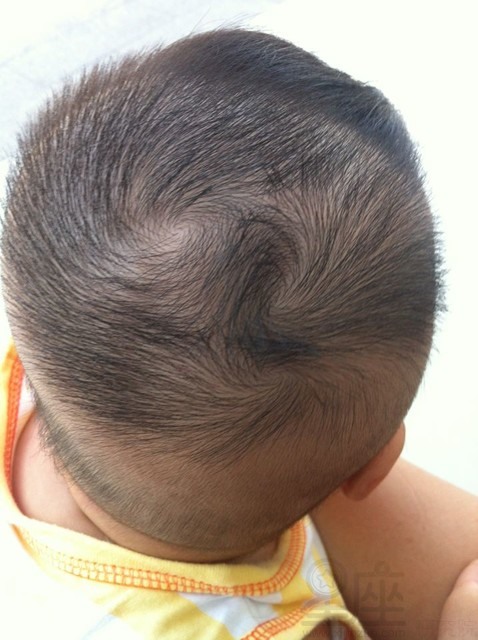 男人头顶双旋有什么说法?头顶双旋命运怎么样?