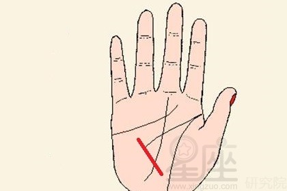 手掌健康线很明显说明什么,身体有疾病吗?